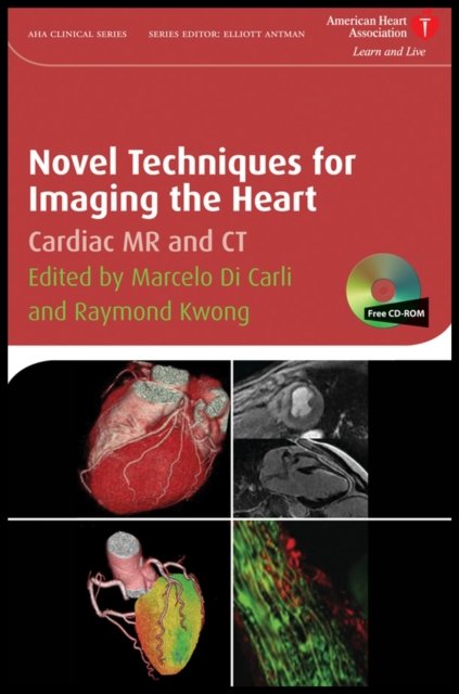 Novel Techniques for Imaging the Heart