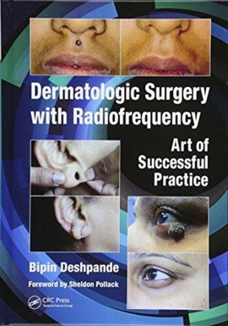 Dermatologic Surgery with Radiofrequency