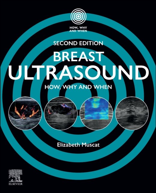 Breast Ultrasound