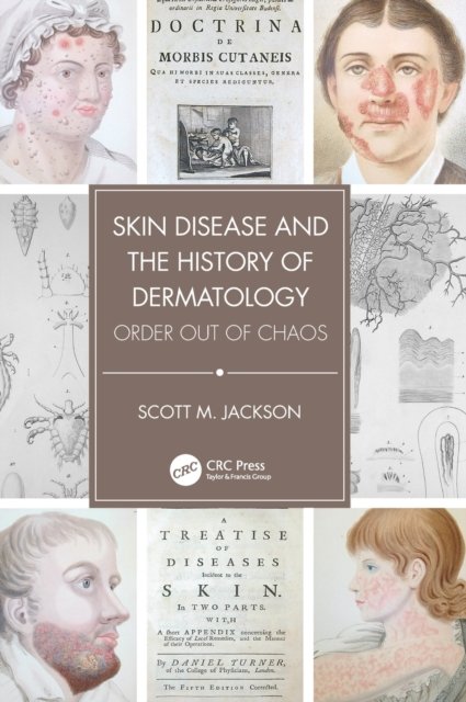 Skin Disease and the History of Dermatology