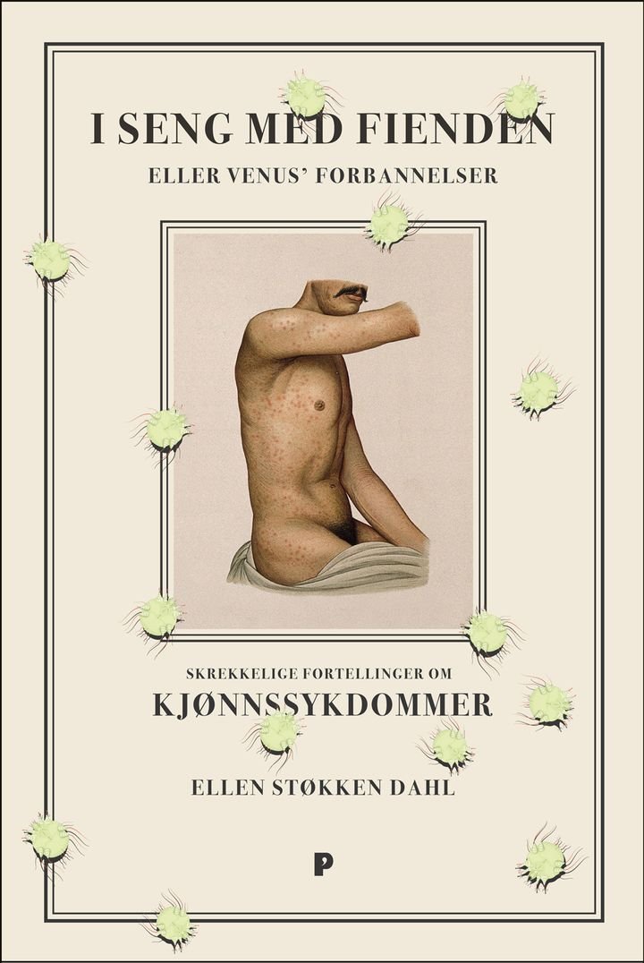I seng med fienden - eller Venus' forbannelser : skrekkelige fortellinger om kjønnssykdommer