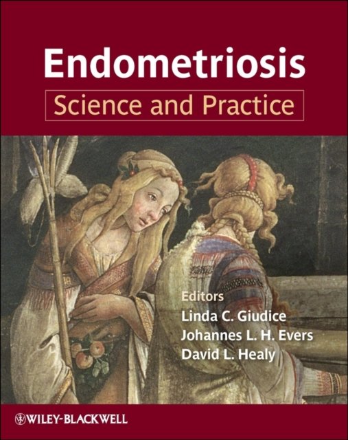Endometriosis – Science and Practice