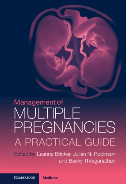 Management of Multiple Pregnancies