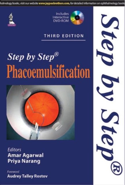 Step by Step Phacoemulsification
