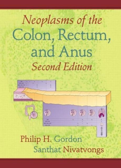 Neoplasms of the Colon, Rectum, and Anus