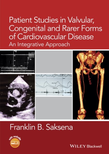 Patient Studies in Valvular, Congenital, and Rarer Forms of Cardiovascular Disease – An Integrative Approach