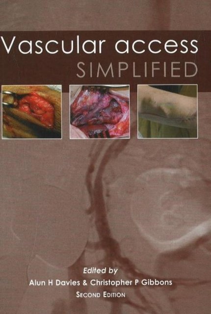 Vascular Access Simplified; second edition