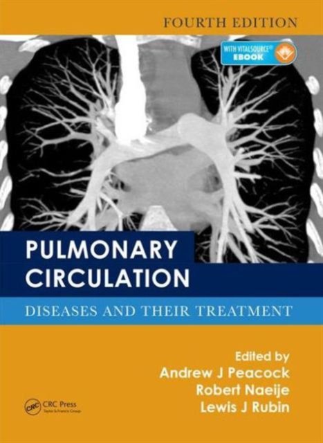Pulmonary Circulation