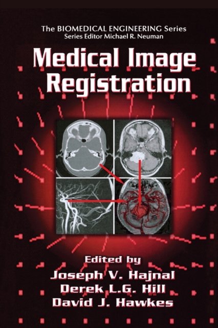 Medical Image Registration