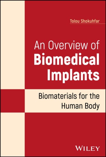 An Overview of Biomedical Implants – Biomaterials  for the Human Body