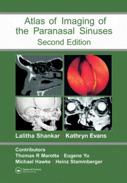 An Atlas of Imaging of the Paranasal Sinuses