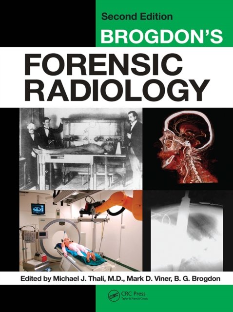 Brogdon''s Forensic Radiology