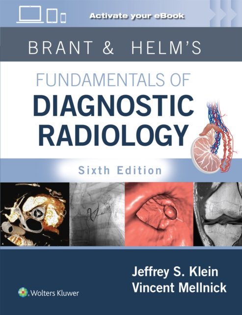 Brant & Helms'' Fundamentals of Diagnostic Radiology: Print + eBook with Multimedia