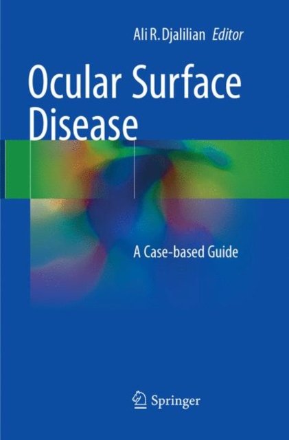 Ocular Surface Disease