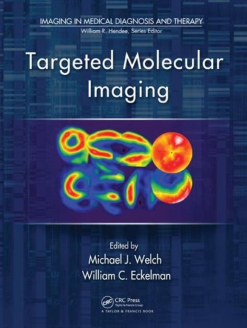 Targeted Molecular Imaging