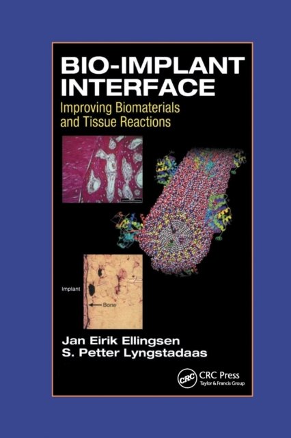 Bio-Implant Interface