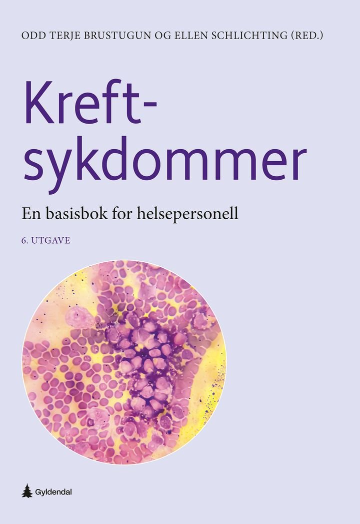 Kreftsykdommer - En basisbok for helsepersonell