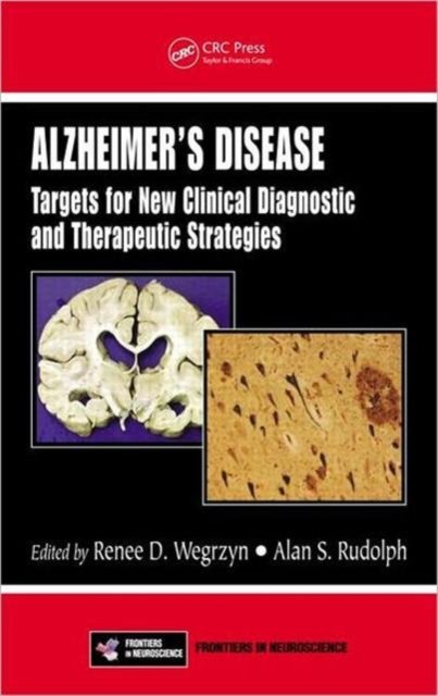 Alzheimer''s Disease