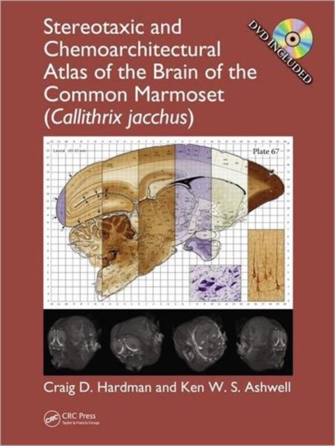 Stereotaxic and Chemoarchitectural Atlas of the Brain of the Common Marmoset Callithrix Jacchus