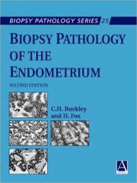 Biopsy Pathology of the Endometrium