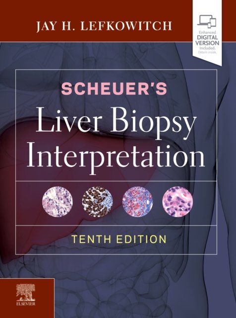 Scheuer''s Liver Biopsy Interpretation