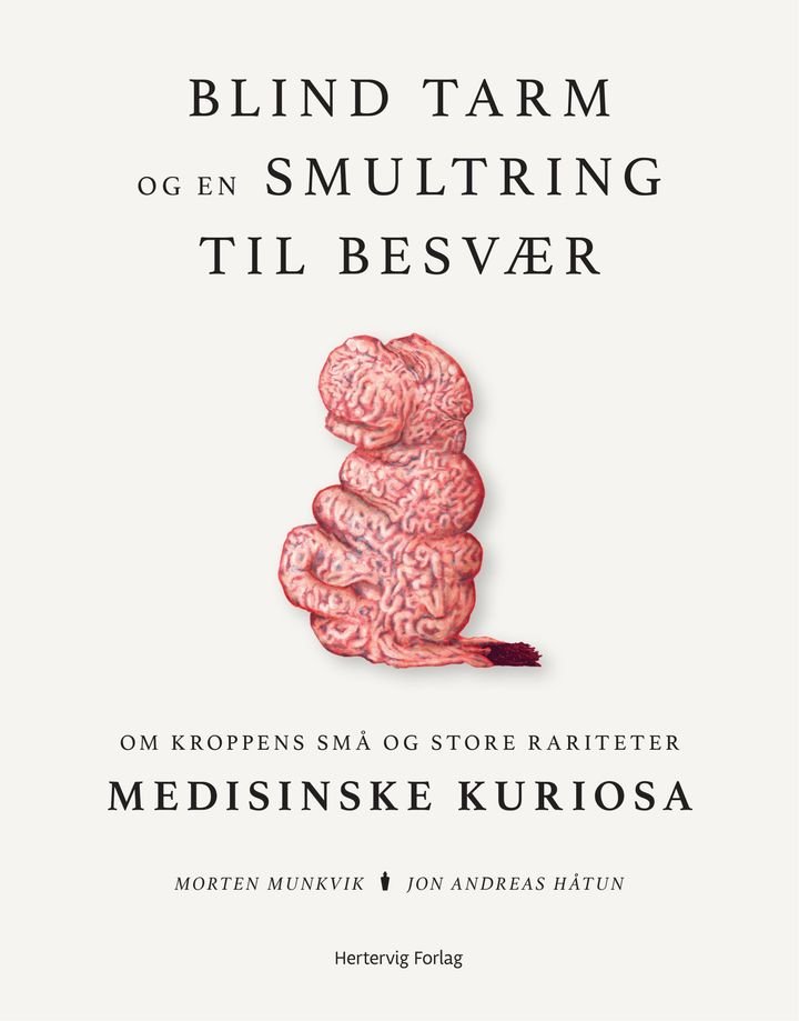 Blind tarm og en smultring til besvær - om kroppens små og store rariteter : medisinske kuriosa