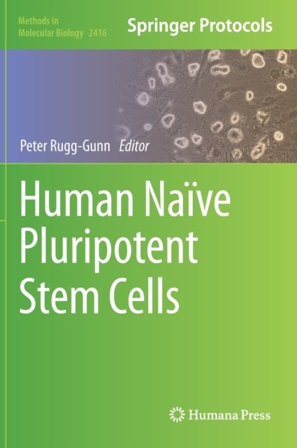 Human Naive Pluripotent Stem Cells