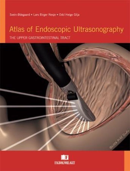 Atlas of endoscopic ultrasonography