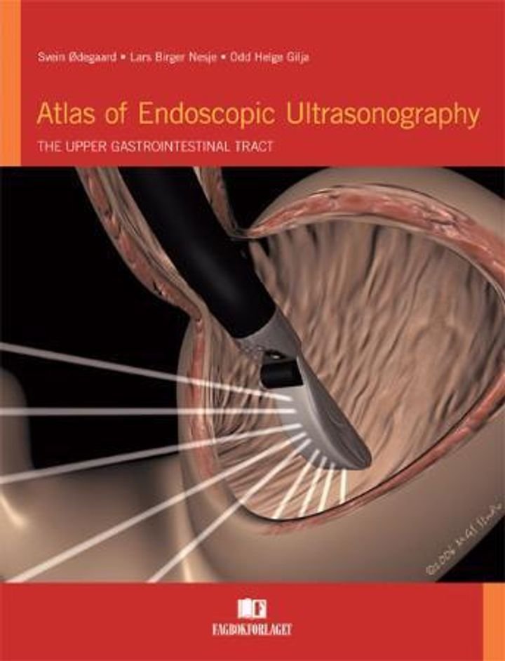 Atlas of endoscopic ultrasonography