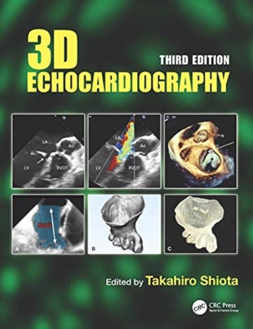 3D Echocardiography