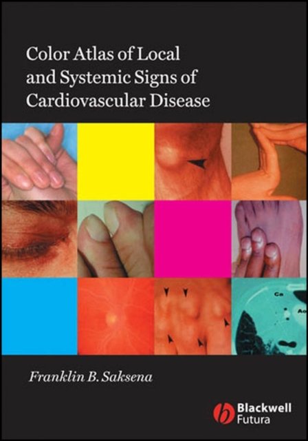 Colour Atlas of Local and Systemic Signs of Cardiovascular Disease