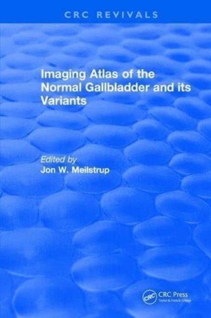 Imaging Atlas of the Normal Gallbladder and Its Variants
