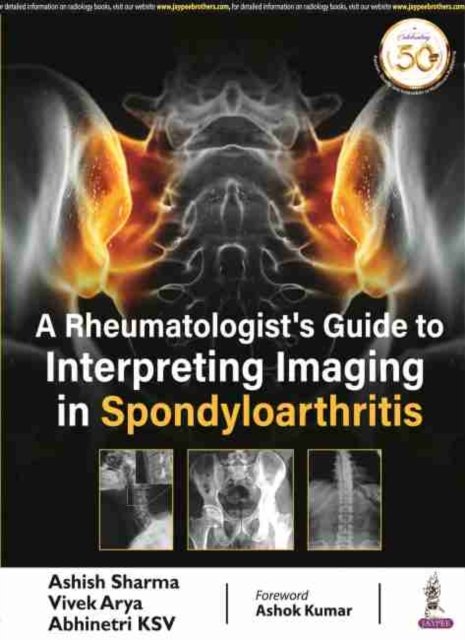 A Rheumatologist's Guide to Interpreting Imaging in Spondyloarthritis