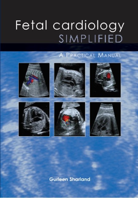 Fetal Cardiology Simplified