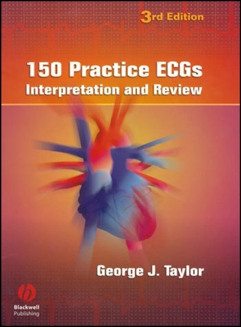 150 Practice ECGs – Interpretation and Review 3e