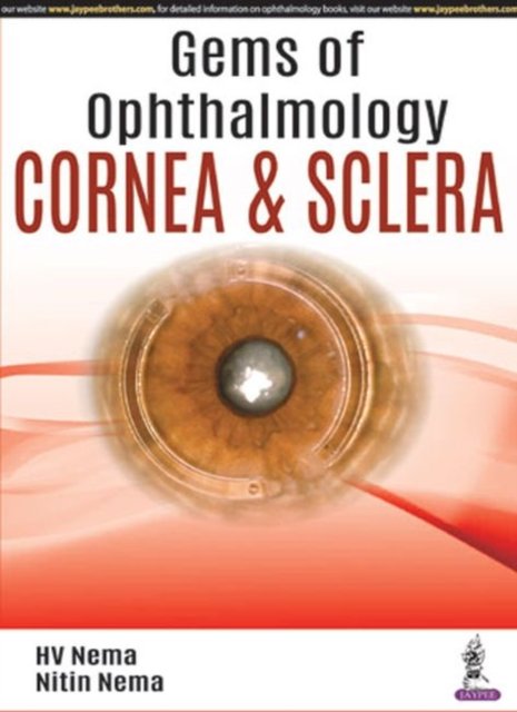 Gems of Ophthalmology