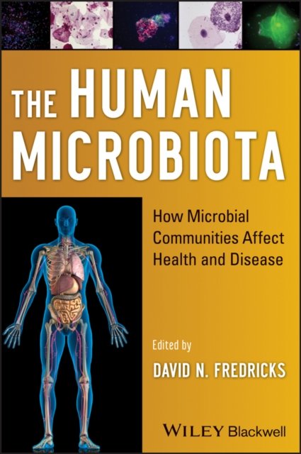 The Human Microbiota – How Microbial Communities Affect Health and Disease