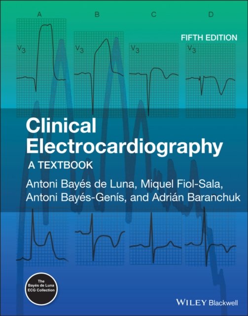 Clinical Electrocardiography – A Textbook 5e