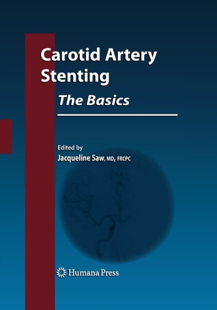 Carotid Artery Stenting: The Basics