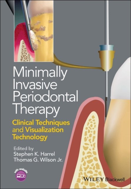 Minimally Invasive Periodontal Therapy – Clinical Techniques and Visualization Technology
