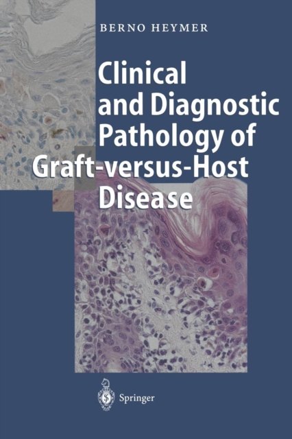 Clinical and Diagnostic Pathology of Graft-versus-Host Disease