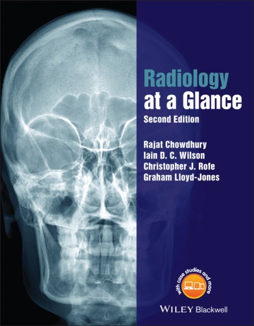 Radiology at a Glance 2e