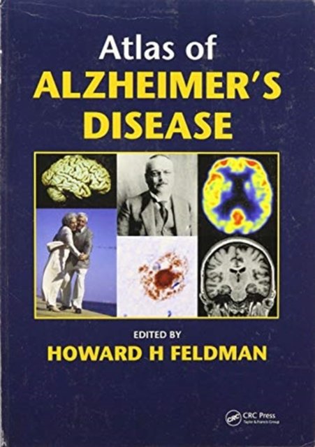 Atlas of Alzheimer's Disease