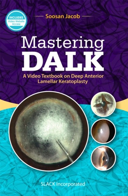Mastering Dalk
