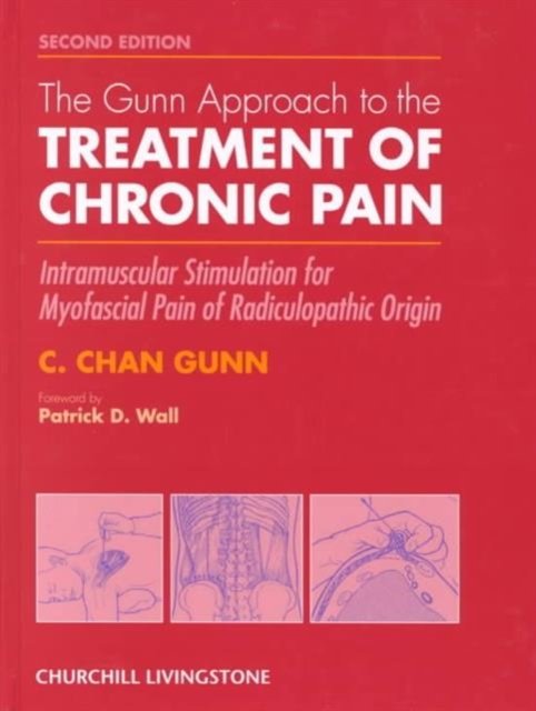 The Gunn Approach to the Treatment of Chronic Pain
