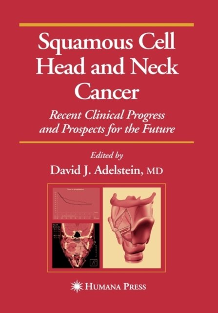 Squamous Cell Head and Neck Cancer
