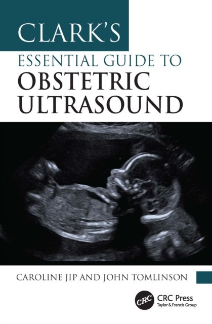 Clark's Essential Guide to Obstetric Ultrasound
