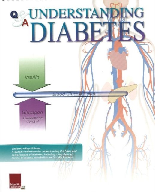 Understanding Diabetes Flip Chart