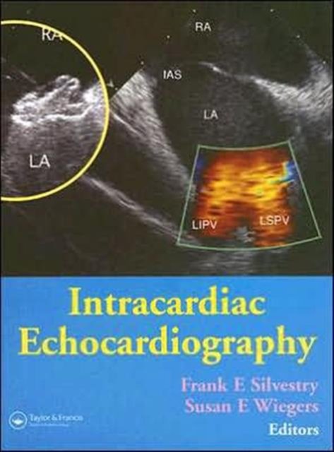 Intracardiac Echocardiography