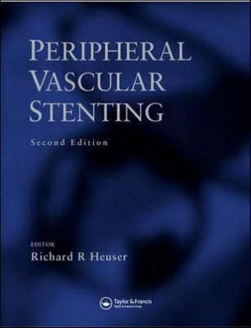 Peripheral Vascular Stenting